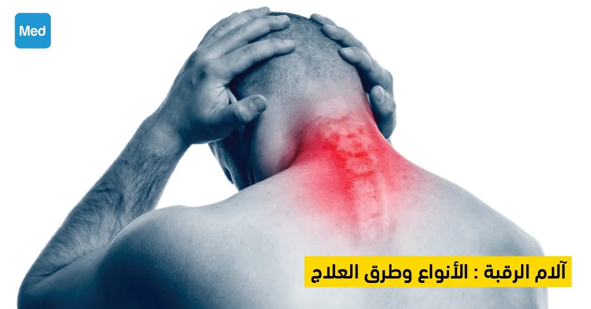 آلام الرقبة : الأنواع وطرق العلاج